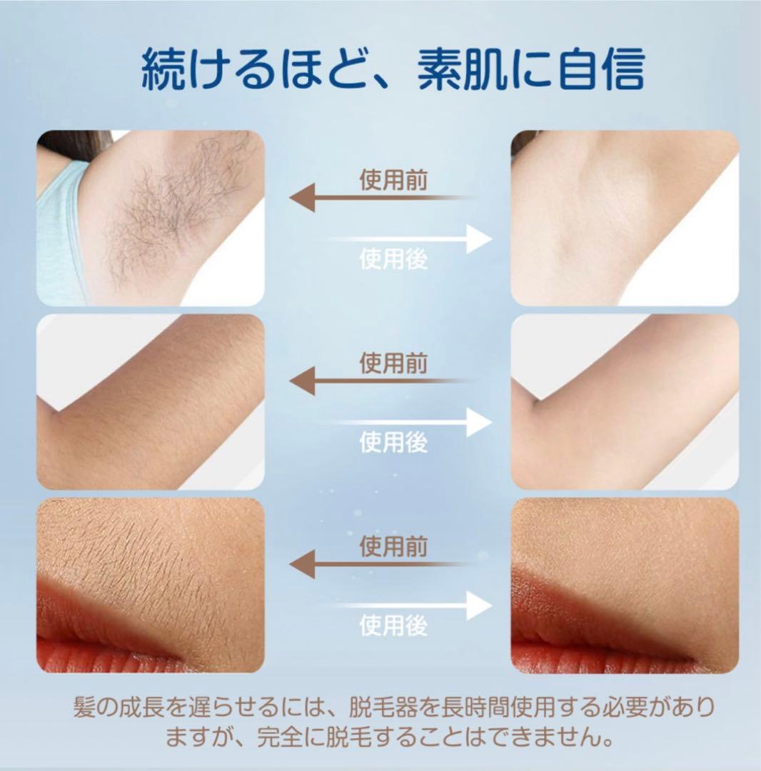 ♡ Sarlisi IPL 光脱毛器 自動照射 美顔器AI01 新品未開封