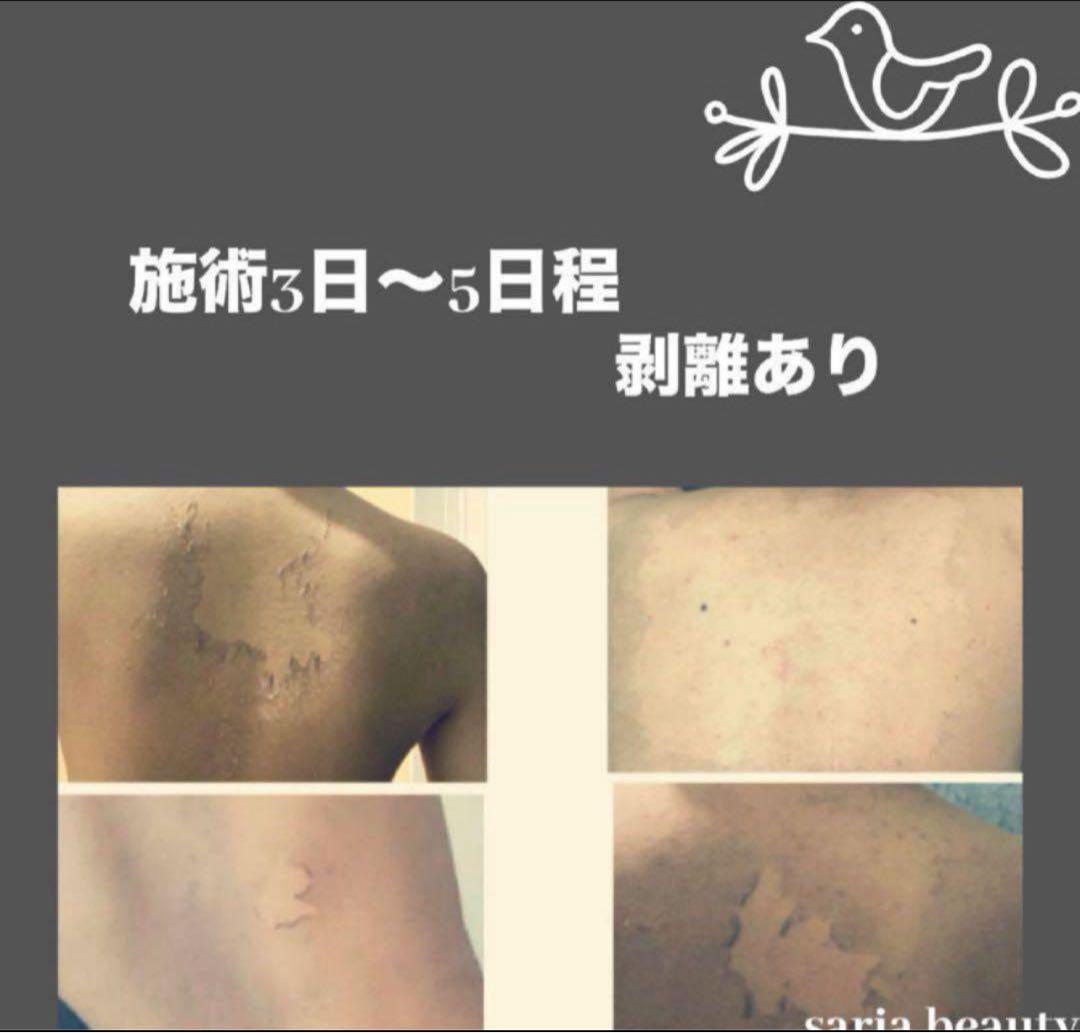 和漢アロエベラ美容液　日本漢方医薬所製造　オーガニック漢方　美白　CICA