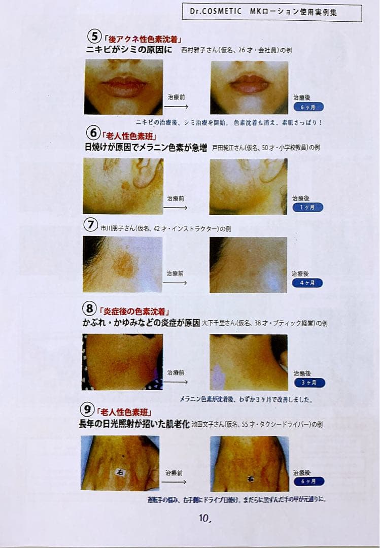 ヴィータ メラスマミルク (100ml) メラニン吸着　排出化粧料　シミ専用乳液