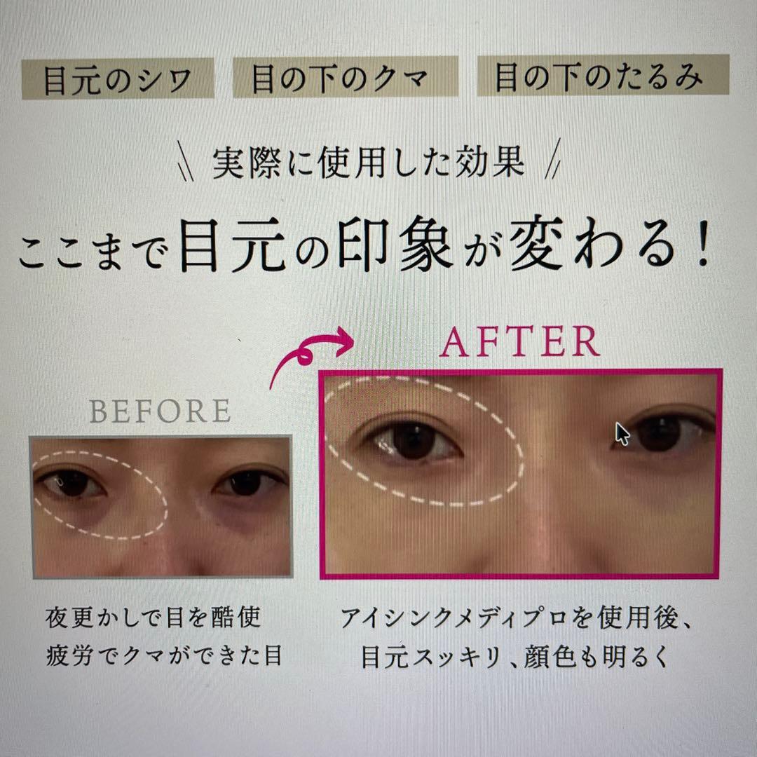 未開封！特価⭐︎京極Eye Sync MediPro 目元美顔器