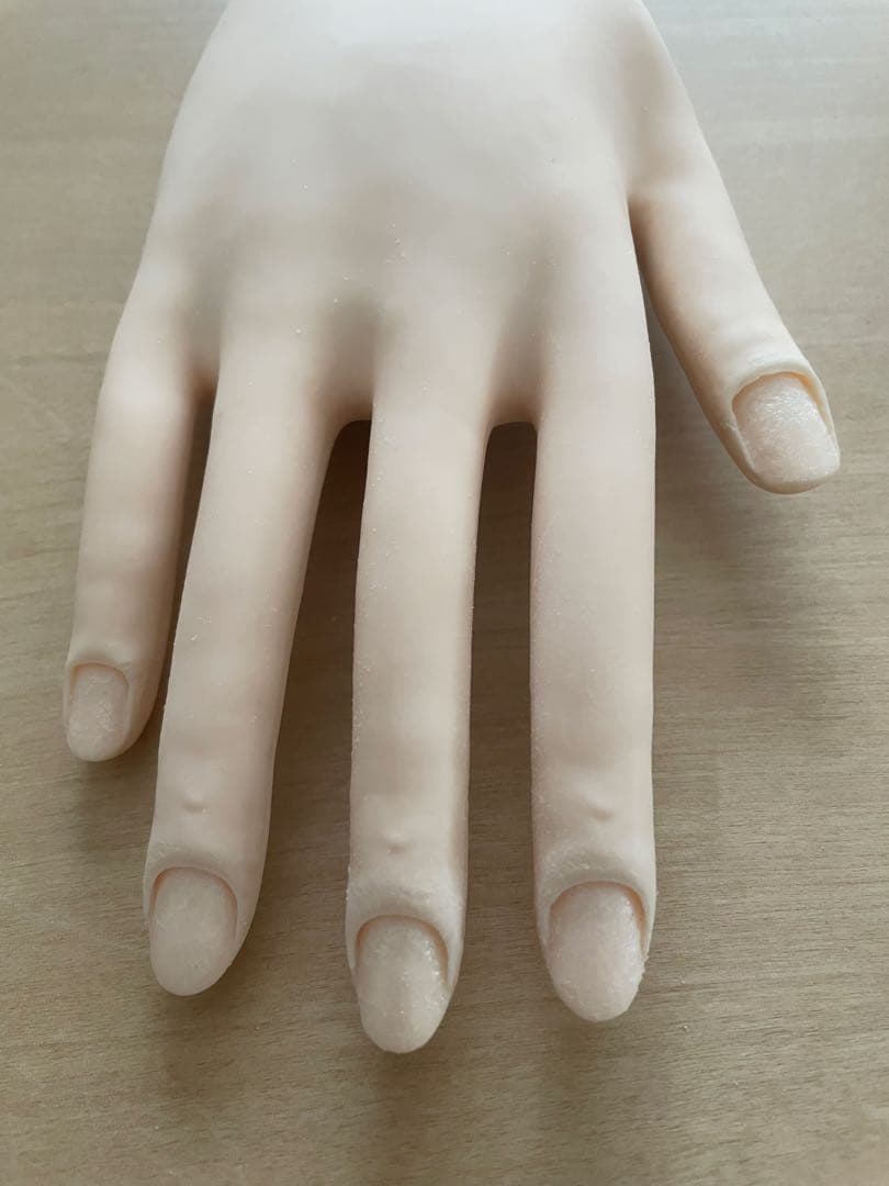 認定ハンド　骨折無し