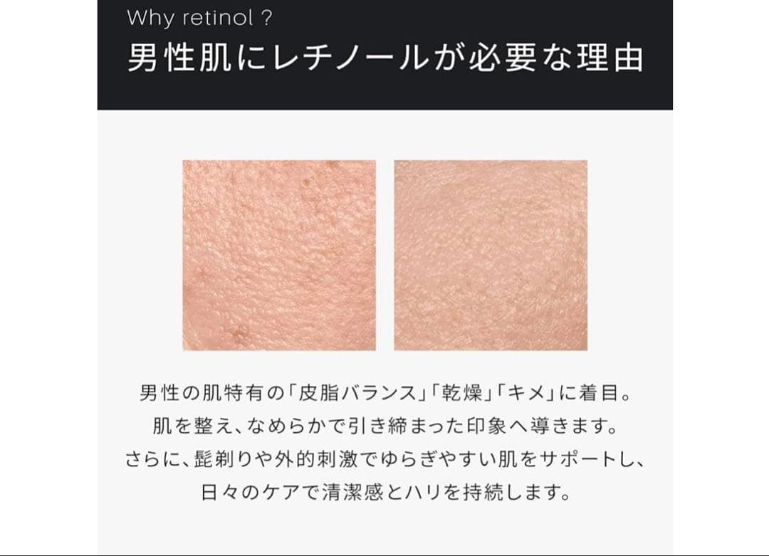 美容液メンズレチノールビタミンE7種毛穴くすみ乾燥日本製30mLATIDIMU