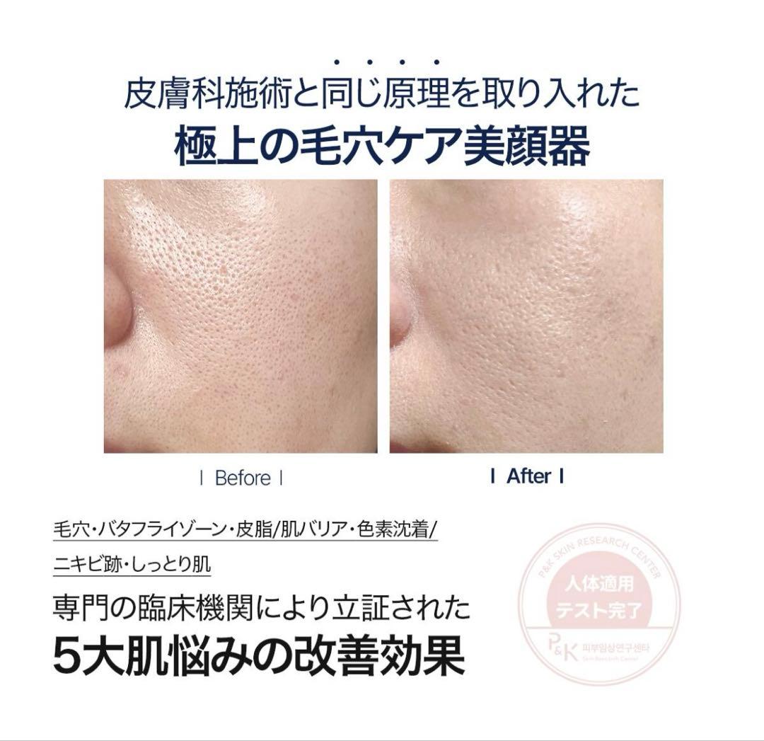 CELORABY PENTASHOT 美顔器セット ペンタショット セラロバイ