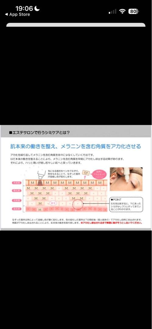 【未使用　新品】低周波シミ取り　ペンシルタイプ　業務用　セルフエステ　開業