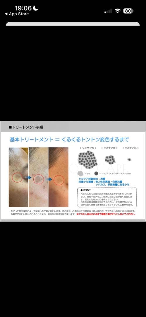 【未使用　新品】低周波シミ取り　ペンシルタイプ　業務用　セルフエステ　開業