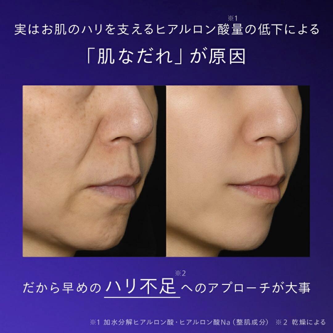 N organic Vie ヒアルアップ リフトクリーム