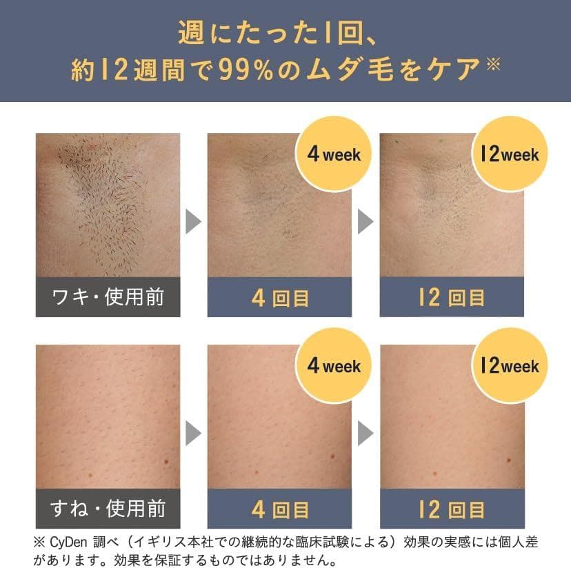 【公式限定】Pure Unplugged SMOOTHSKIN 美容 脱毛器