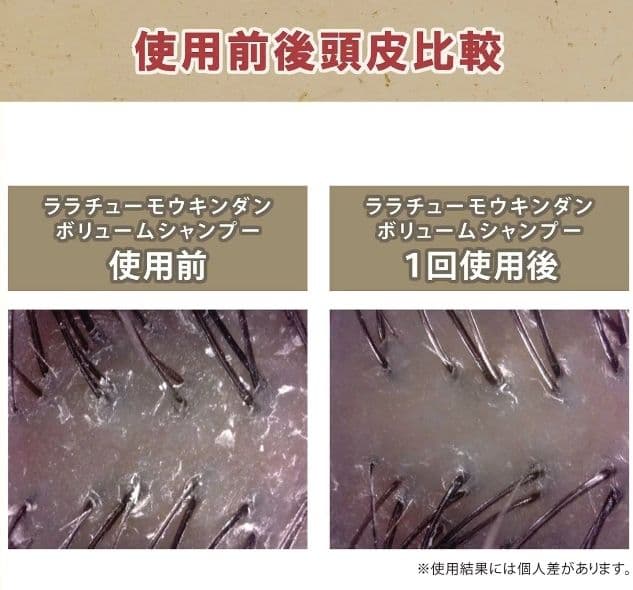 【モウキンダン ボリュームシャンプー】金色に輝く漢方シャンプー石鹸置き付き送料込