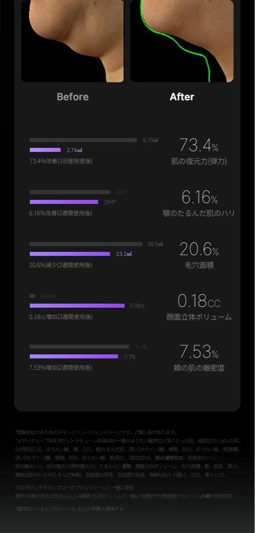 メディキューブ AGE-R ウルトラチューン40.68