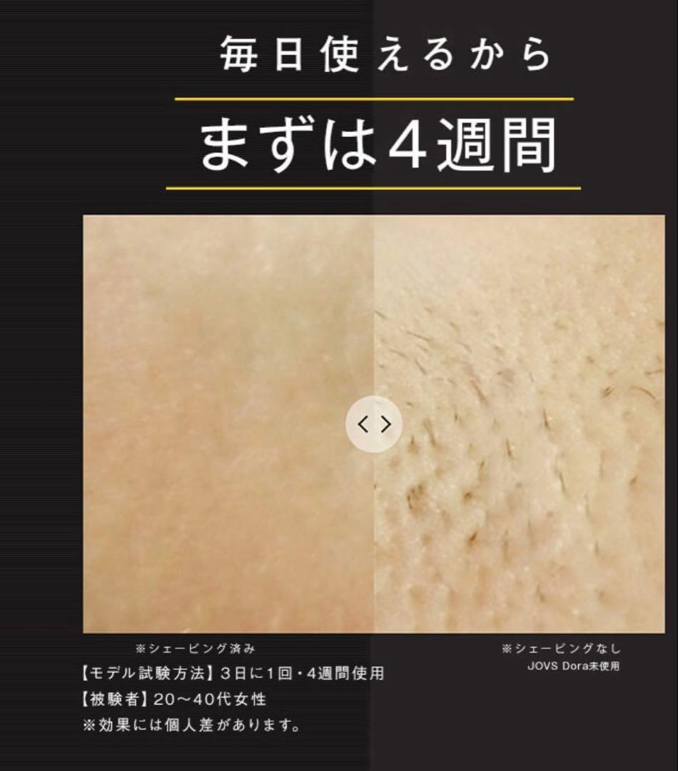 JOVS Dora 2023年モデル　脱毛器