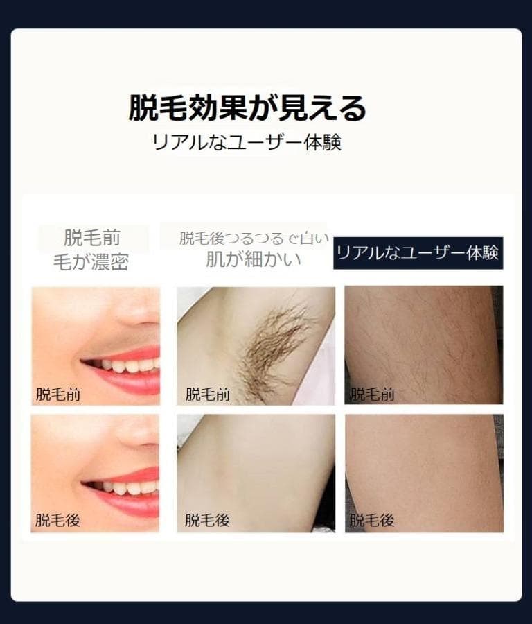ICE COOL Hair Removal System / アイスクール脱毛