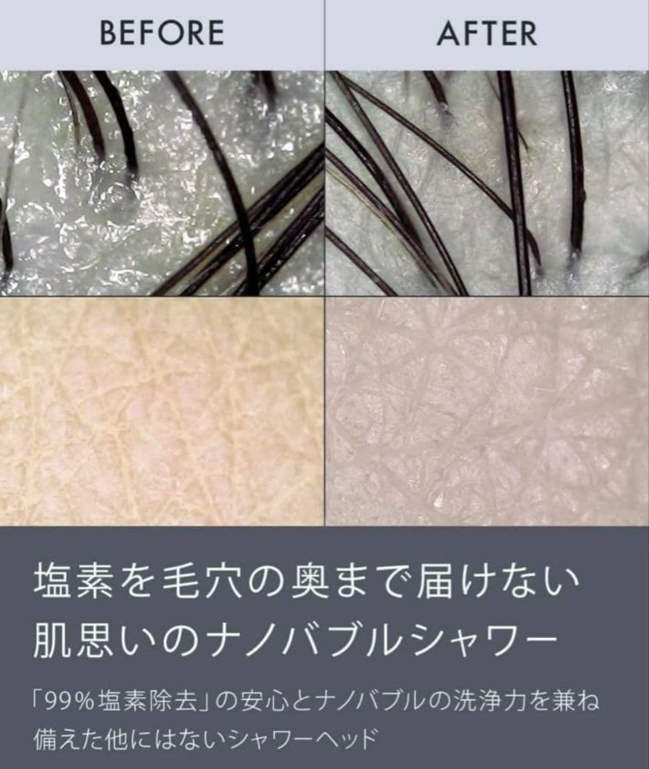 ■Nоendシャワーヘッド■ 塩素除去節水■ナノバブル増圧■NB‐SH-002