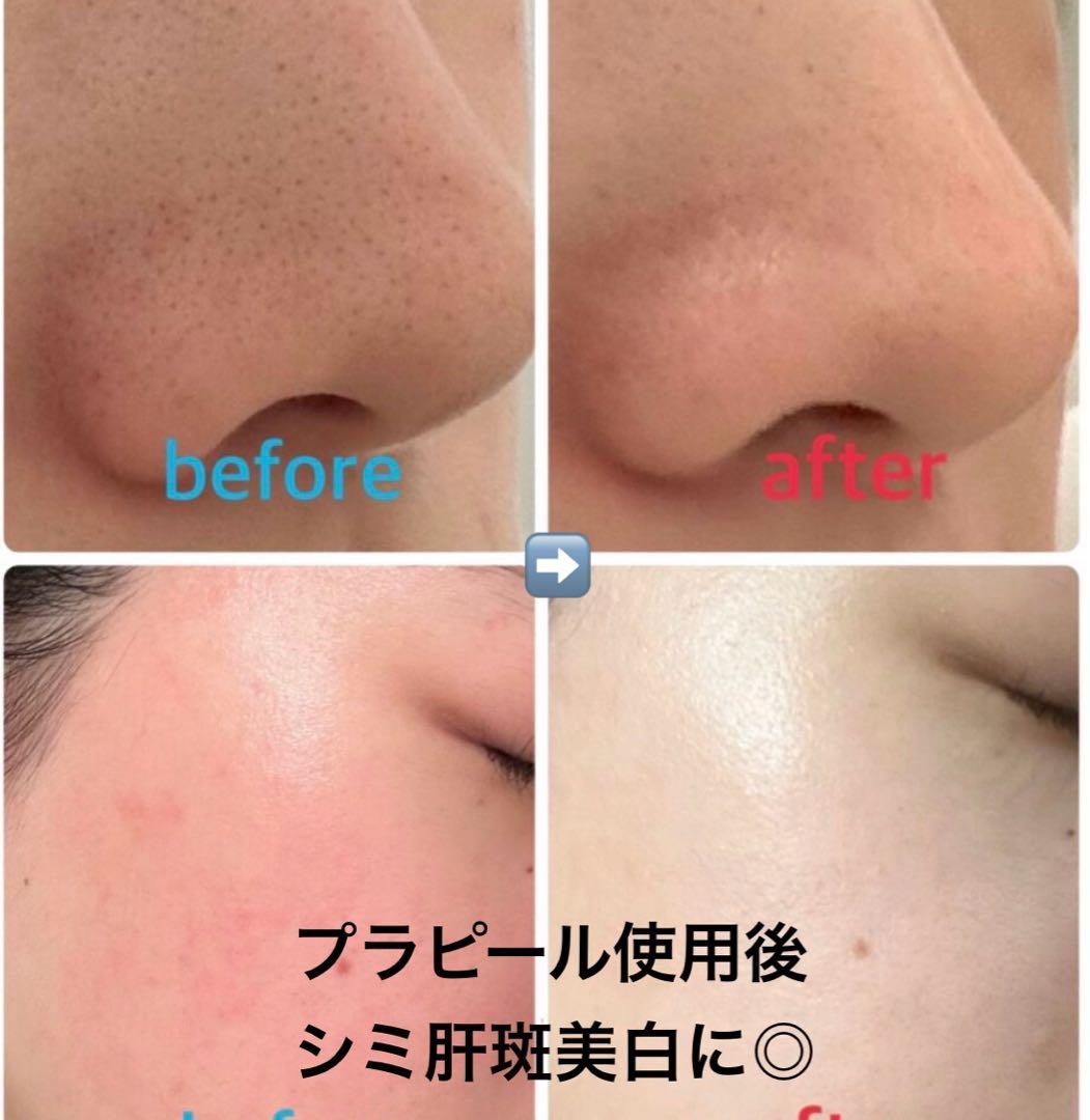 複数割引◎プラピール【3set9回分】6,980円