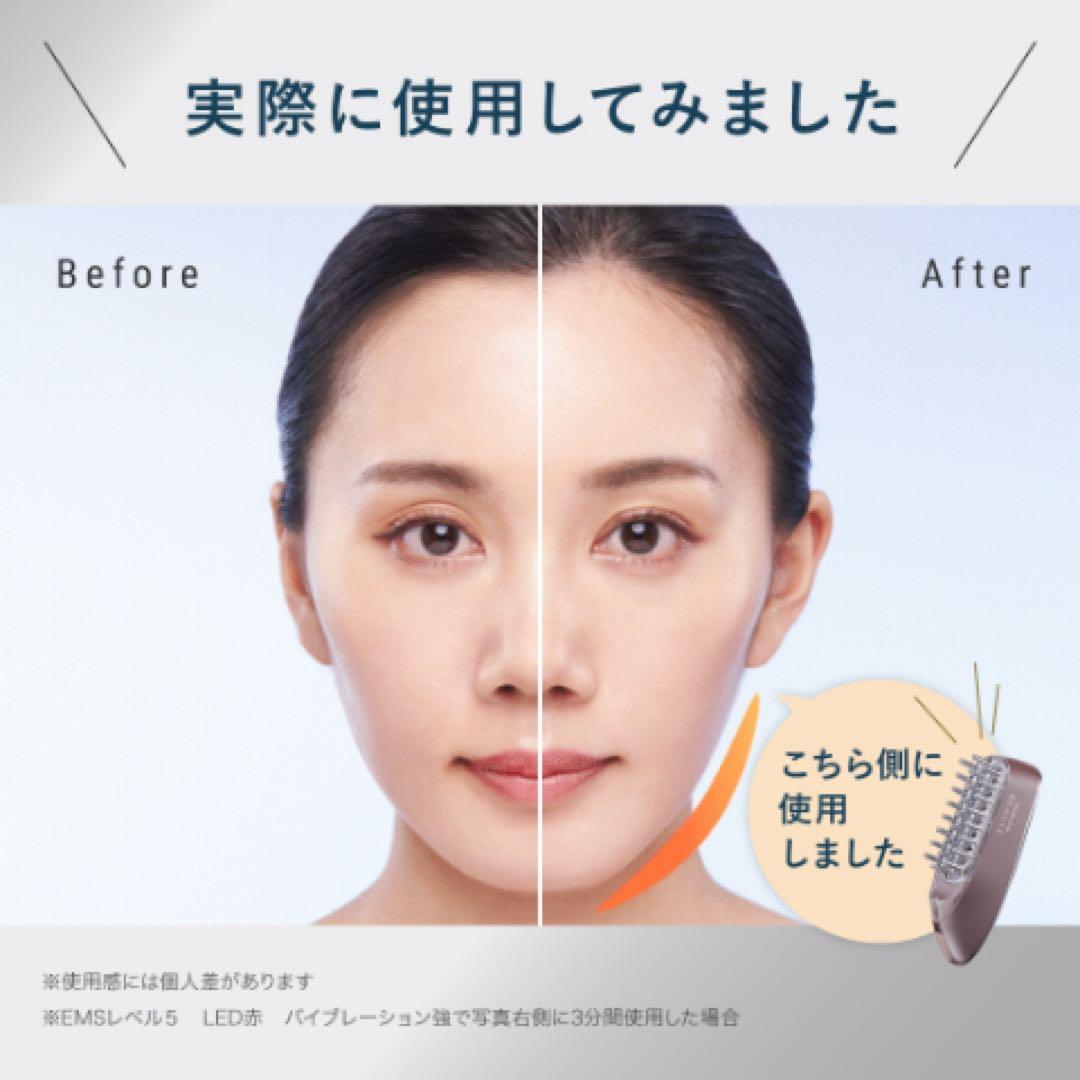 アンファー スカルプDボーテ スカルプ電気ブラシ