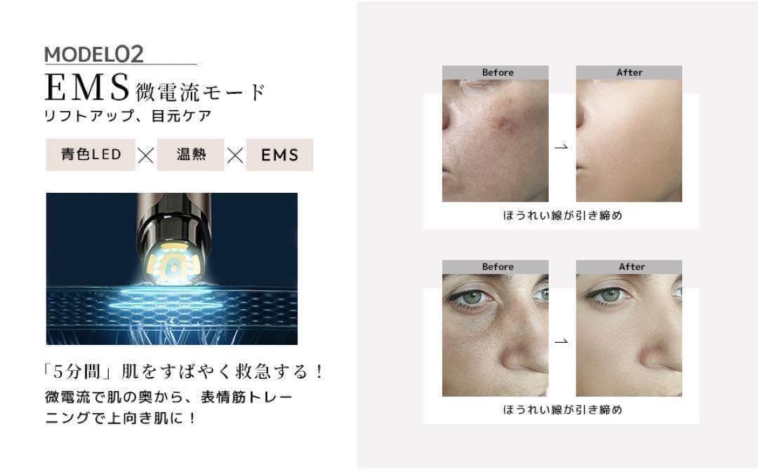美顔器 高周波多機能EMS微電流 温熱 イオン導入 LED 防水