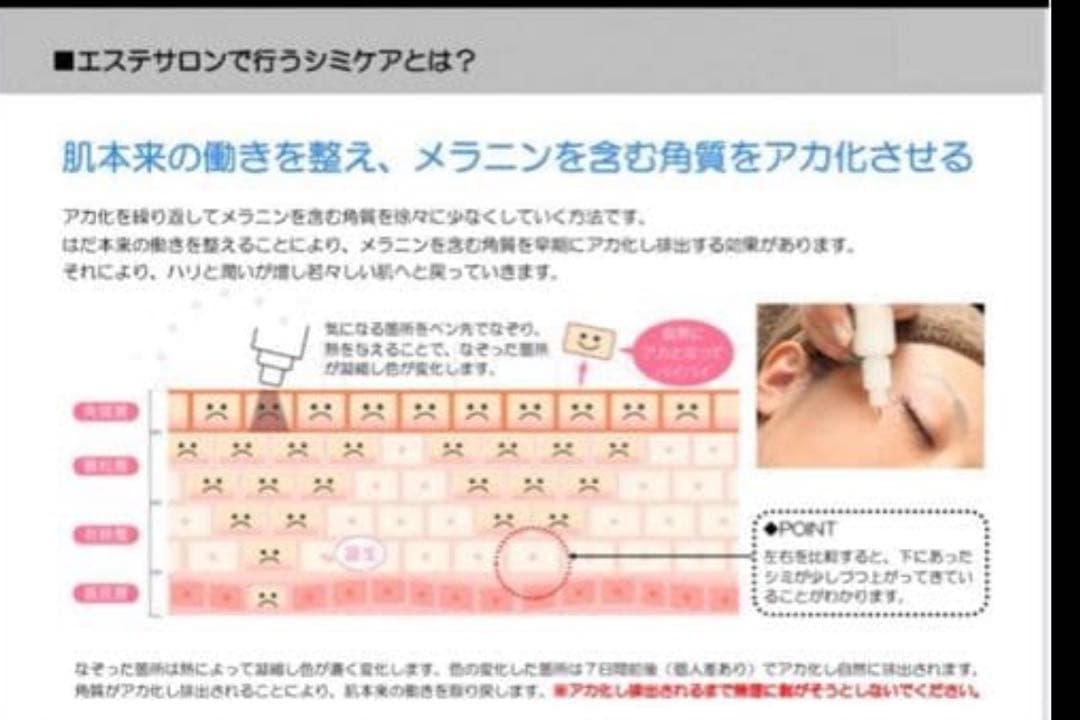 低周波ペンシル　シミケア　シミ取り　ペン　美顔　マシン　エステ　デトックスケア