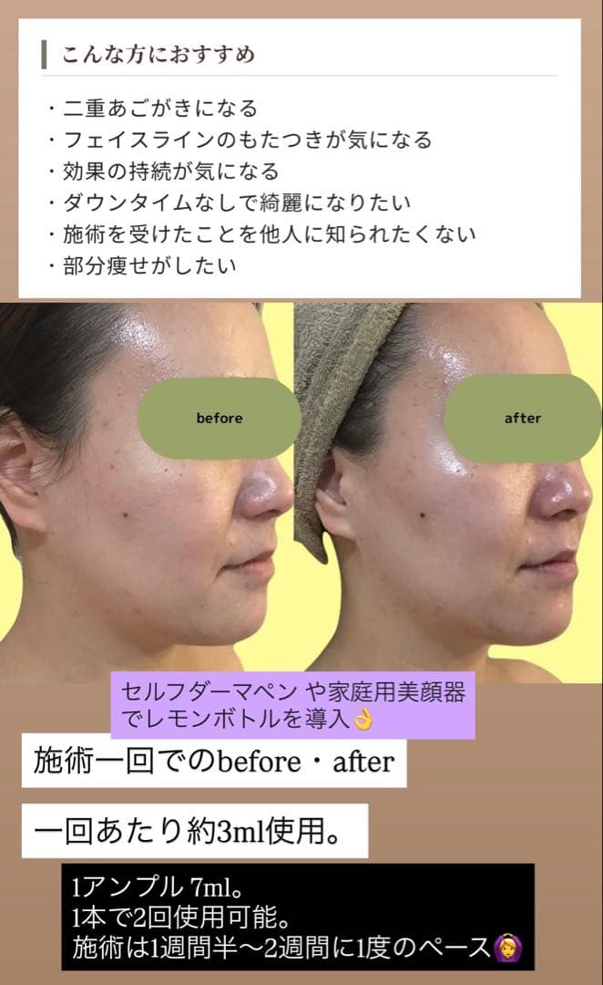 ひとみ　レモンボトル、リジュラン、白玉グルタチオン