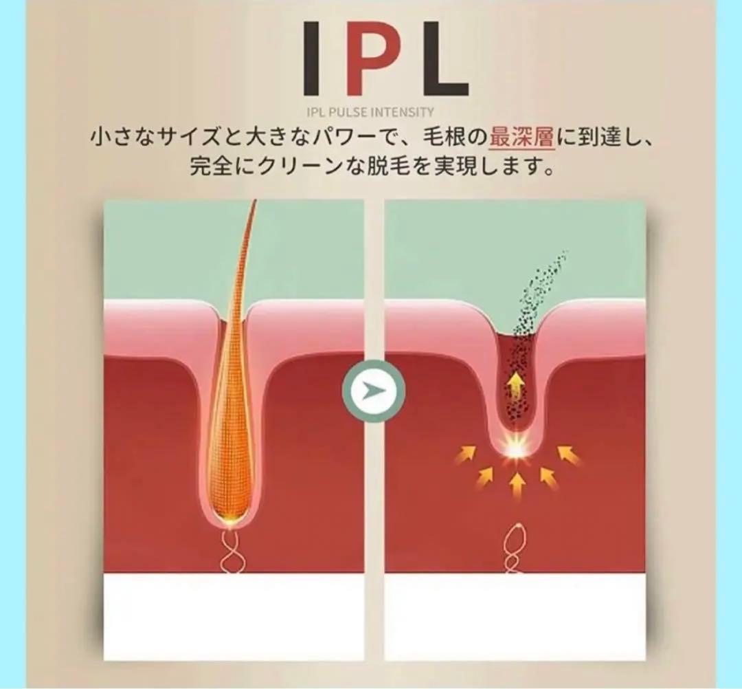 【❣️】全身使用可 IPL光脱毛器 99万発照射 家庭用 VIO可 男性女性OK✨️