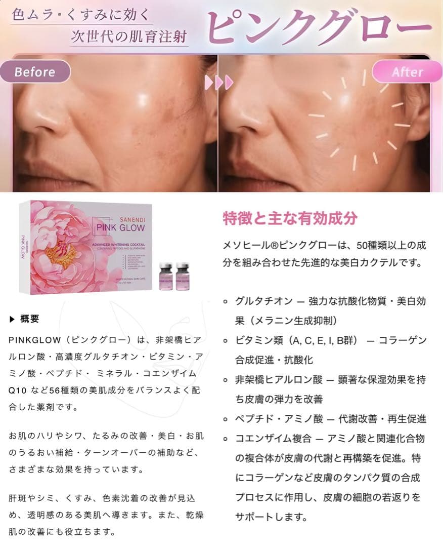 rrrmm　ピンクグロー２本