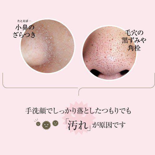 ヤーマン YAMAN ウォーターピーリング