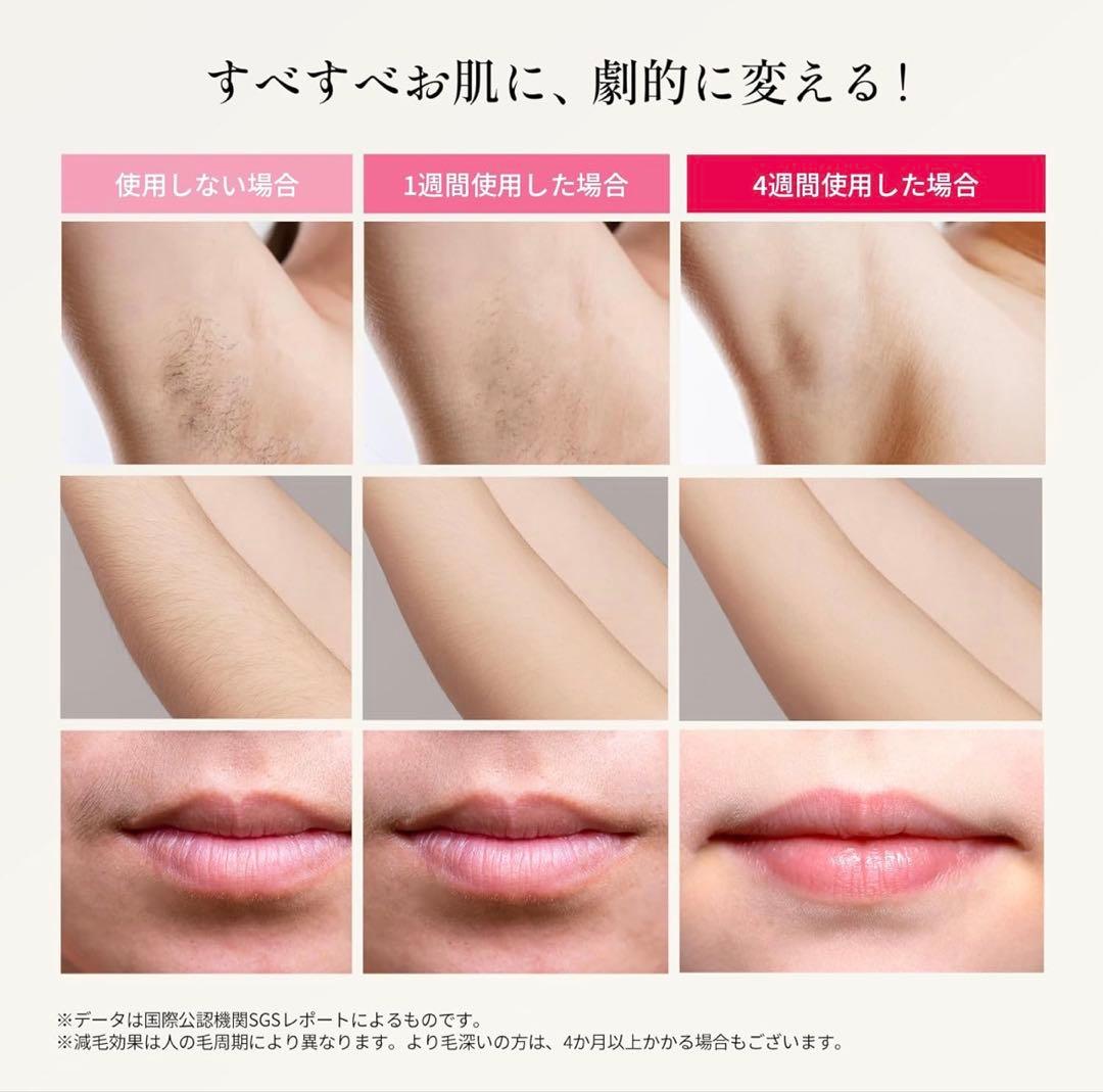 【新品未使用】Ulike Air Pro 脱毛器