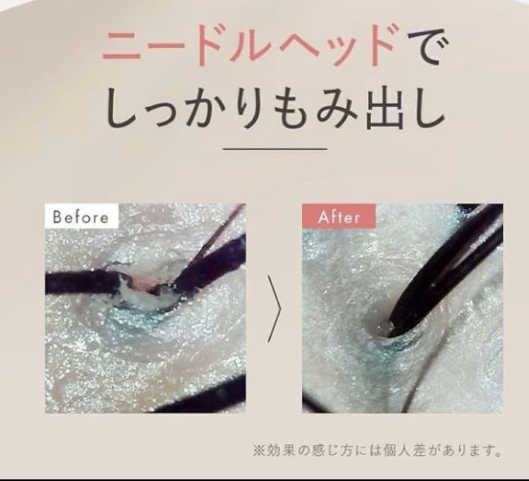 MUSTEM 家庭用美容器ヘッドスパ　EMS 揉み出しアタッチメント付き
