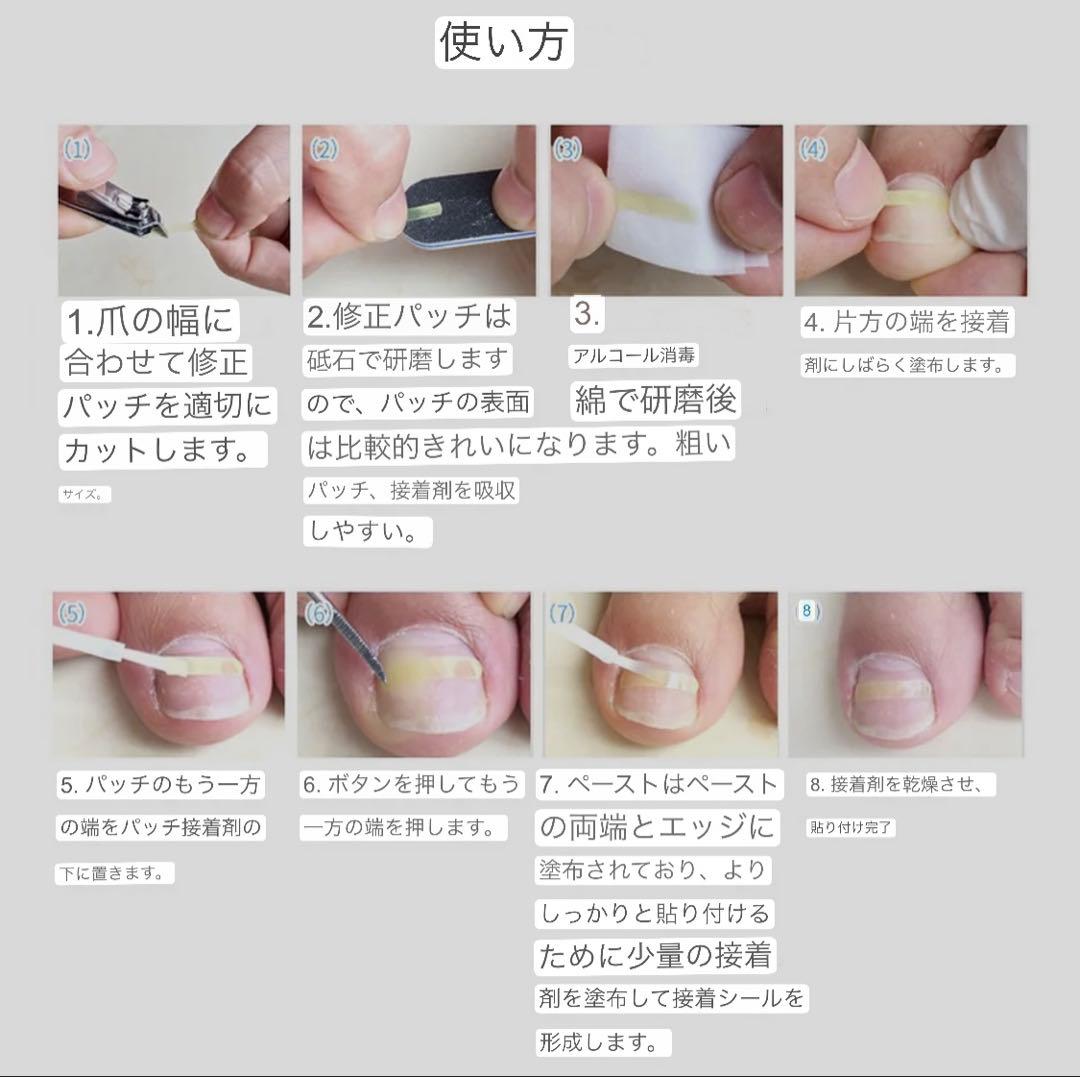 業務用　ネイル　巻き爪　ケア　プレート　20個(200枚)