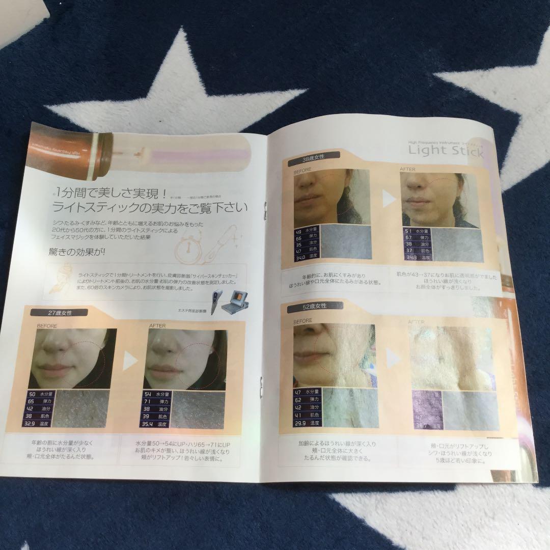 ライトスティック マイナスイオン美顔器 定価……¥15.000