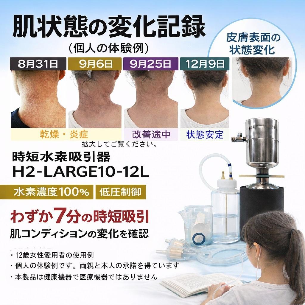 水素吸引臨床最強モデル・時短水素吸引器H2-LARGE30-35L水素700L付
